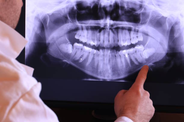 Best Broken or Chipped Tooth Repair in Dundee, NY