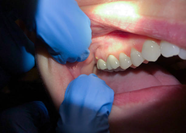 Professional Emergency Dental Service in NY